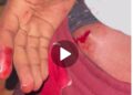 Tema: Assembly Member Hamza Issaka Kidnaps Business Partner; Stabs him Multiple times